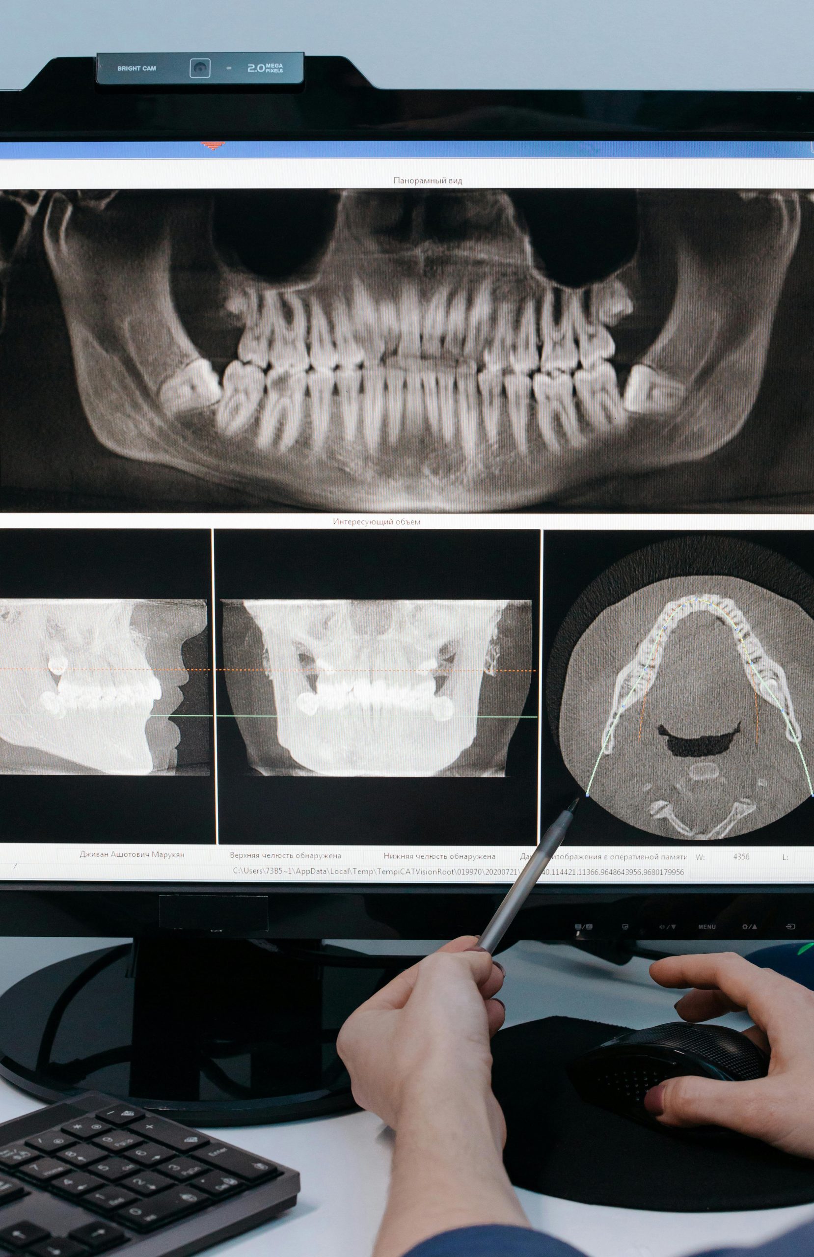 Photo by cottonbro studio: https://www.pexels.com/photo/an-x-ray-image-of-a-jawbone-in-the-computer-6502019/