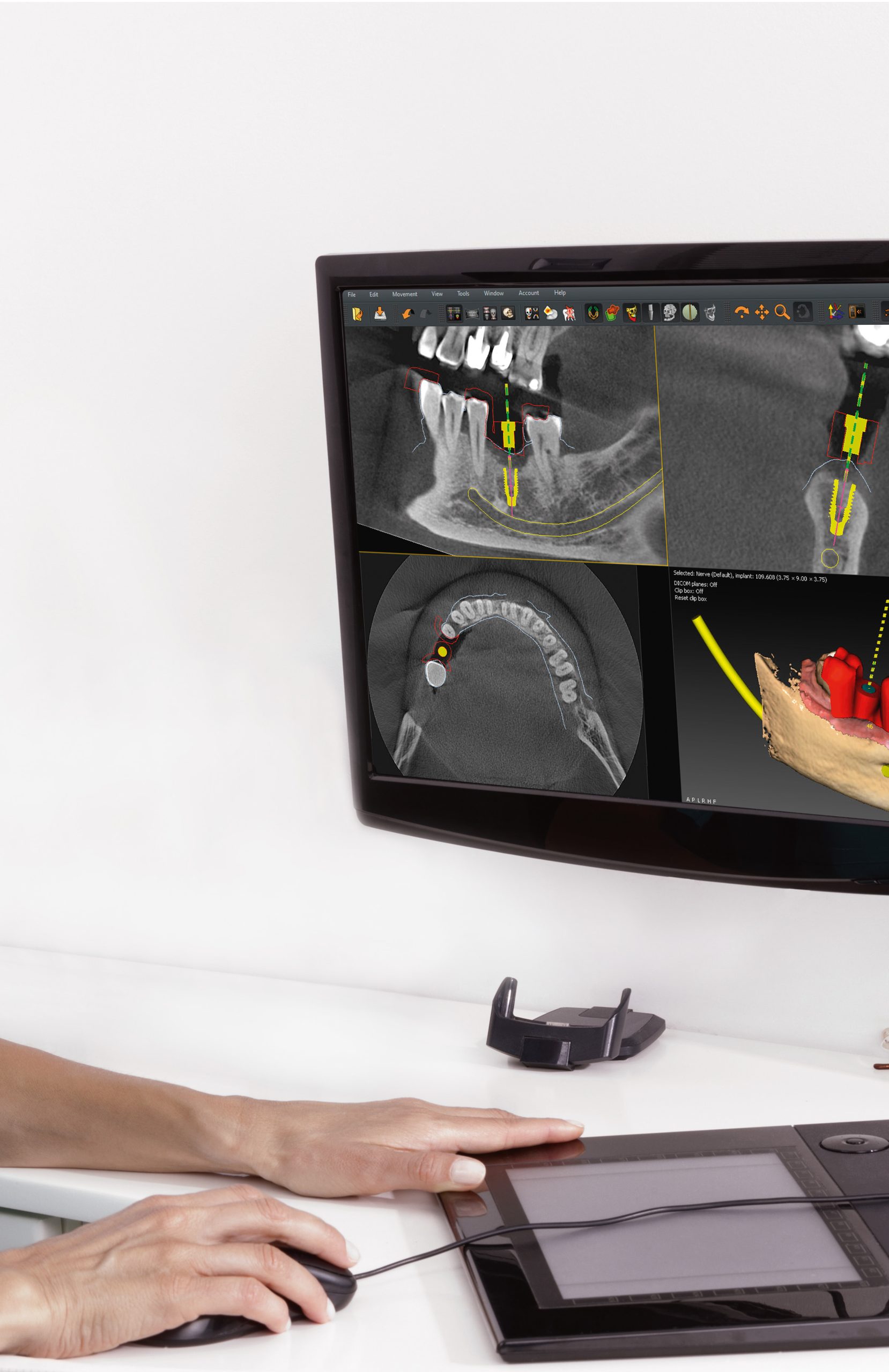 equipements de radiologie dentaire à nice